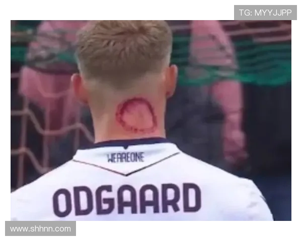 奥德加德比赛影响力